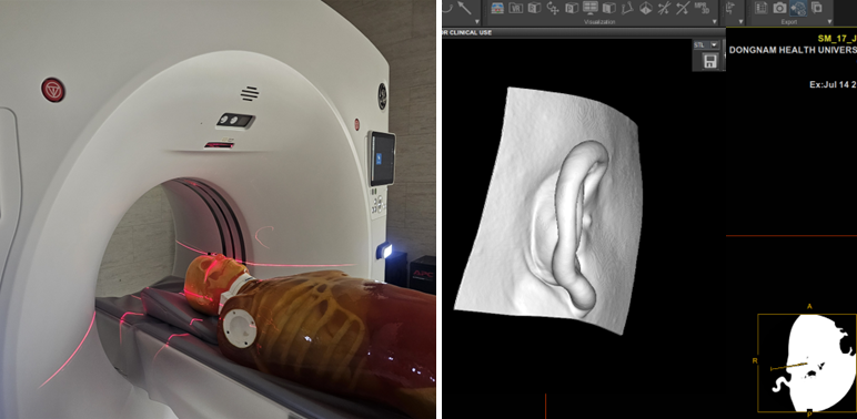 삼성전자 – 동남보건대학교 방사선학과,  ‘개인별 실이(Ear Structre) 3D 모델링 데이터 제작 연구’ 공동 성과 창출 첨부 이미지